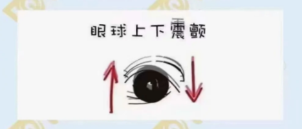 什么是眼球震顫？